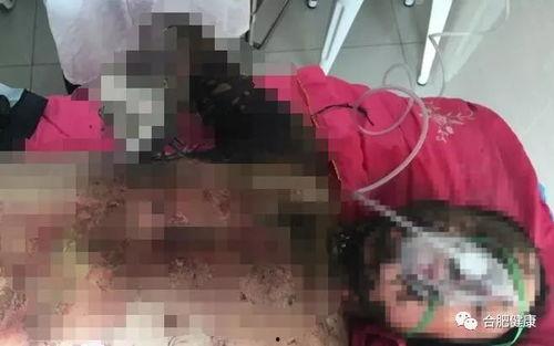 如皋医院爆料烧伤视频,惨烈现场令人揪心 第1张 如皋医院爆料烧伤视频,惨烈现场令人揪心 第1张
